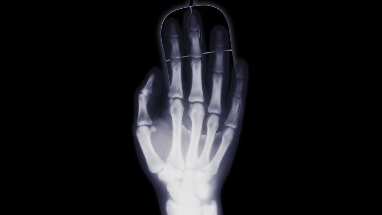 Обои рука, рентген, кости, компьютерная мышь
