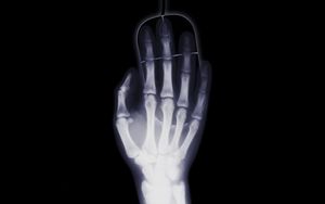 Превью обои рука, рентген, кости, компьютерная мышь