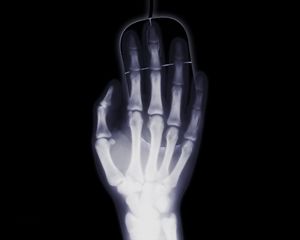 Превью обои рука, рентген, кости, компьютерная мышь